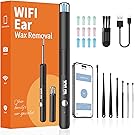 【50%OFF+ポイント10%】【実質672円】 Xylla Type-C充電式 1920P WiFi接続 耳かきカメラ